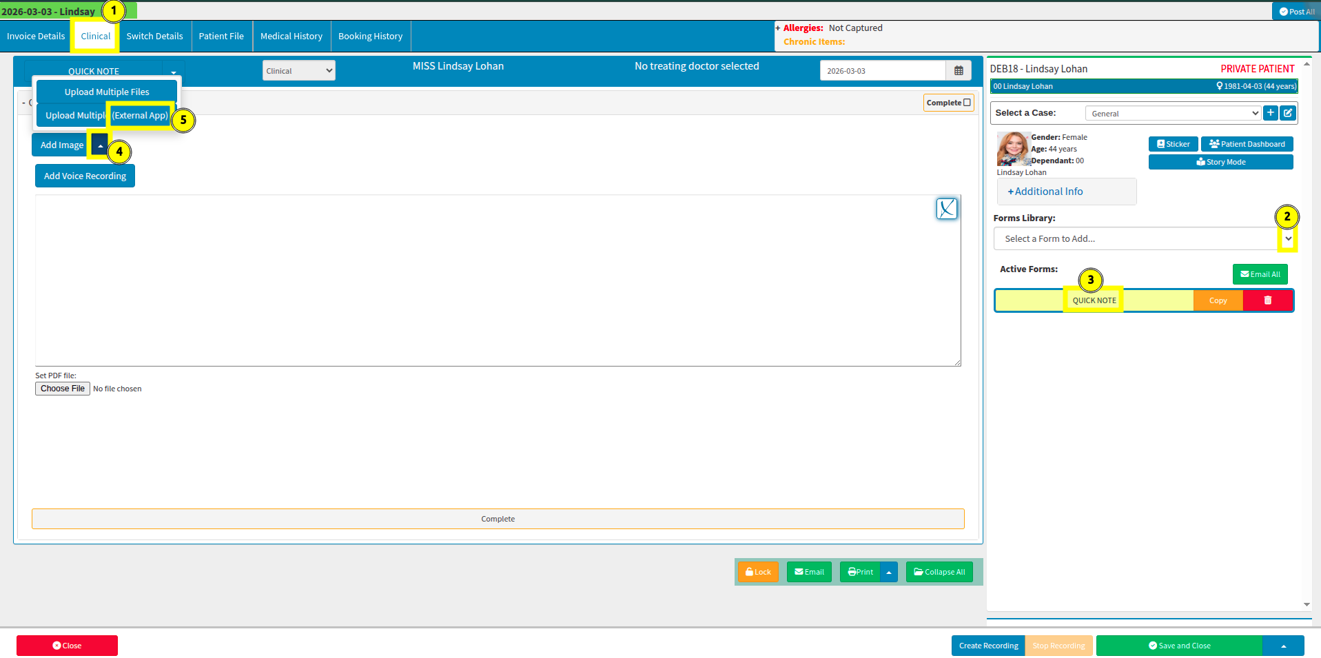 Step by step guide around voice recordings