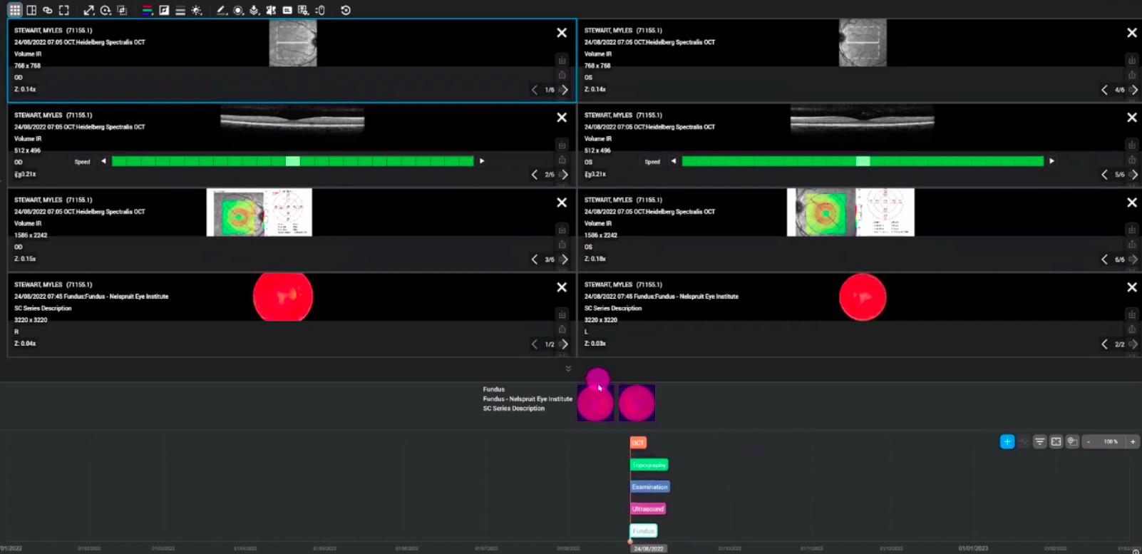 Harmony Interface example
